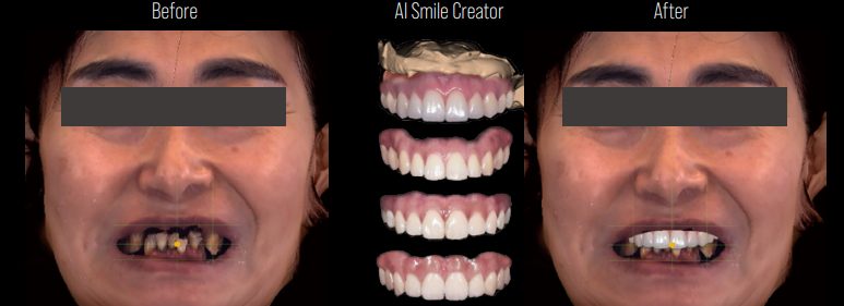AI Smile Creator — Before / After